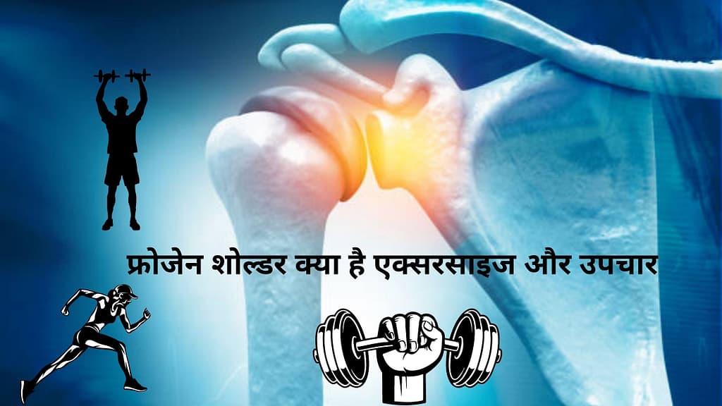 फ्रोजेन शोल्डर क्या है एक्सरसाइज और उपचार