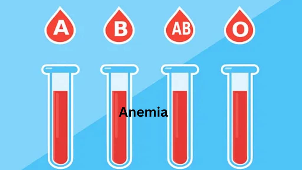 Anemia