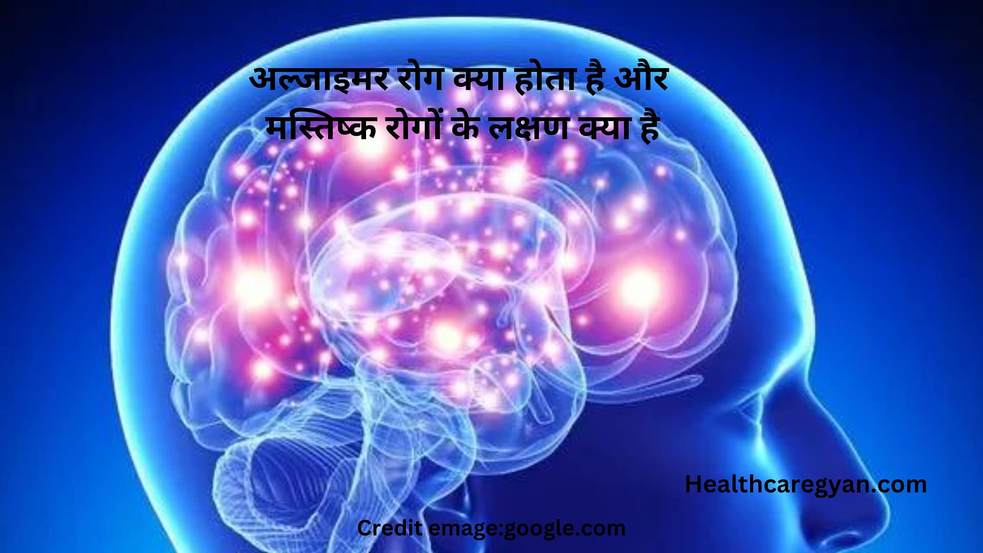 Alzheimer's disease In Hindi
