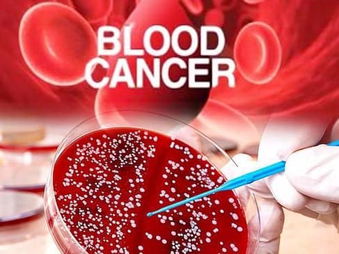 Blood Cancer