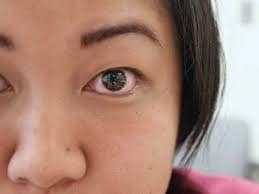 ऐसे करें इस्तेमाल: